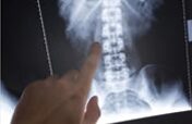 Chiropractic x-ray equipment