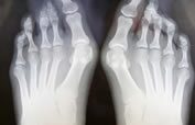 Podiatry x-ray equipment