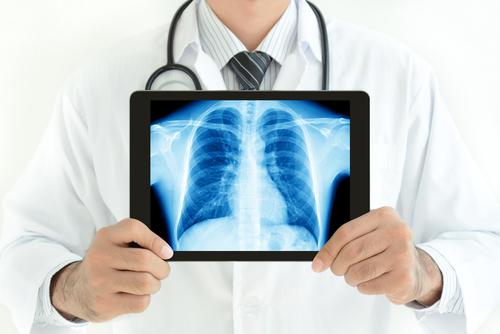 Doctor holding a tablet with a digital x-ray
