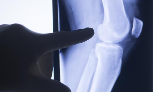 Radiologist reviewing x-ray films